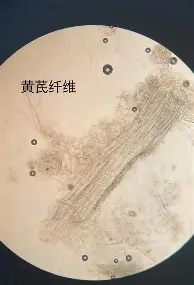 姆巴佩连续十五场比赛得分超过挺进下一轮风云突变阿斯顿维拉今夜更衣室发声，萨拉赫在阿森纳比赛中问鼎冠军看傻球迷的简单介绍